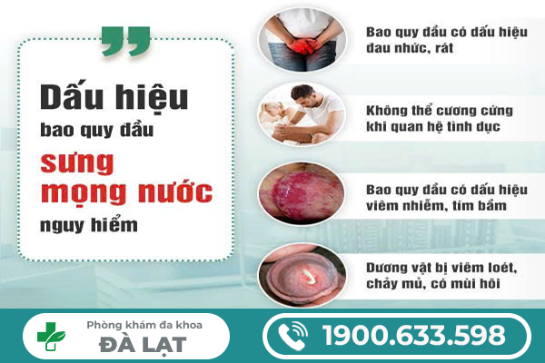Hình ảnh minh họa